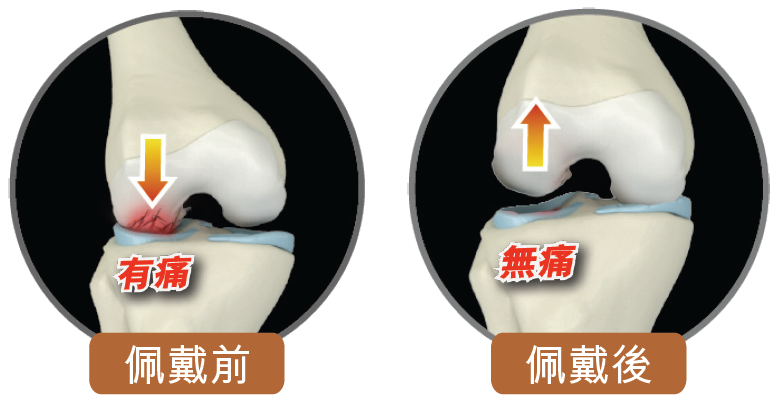 Knee joint comparison
